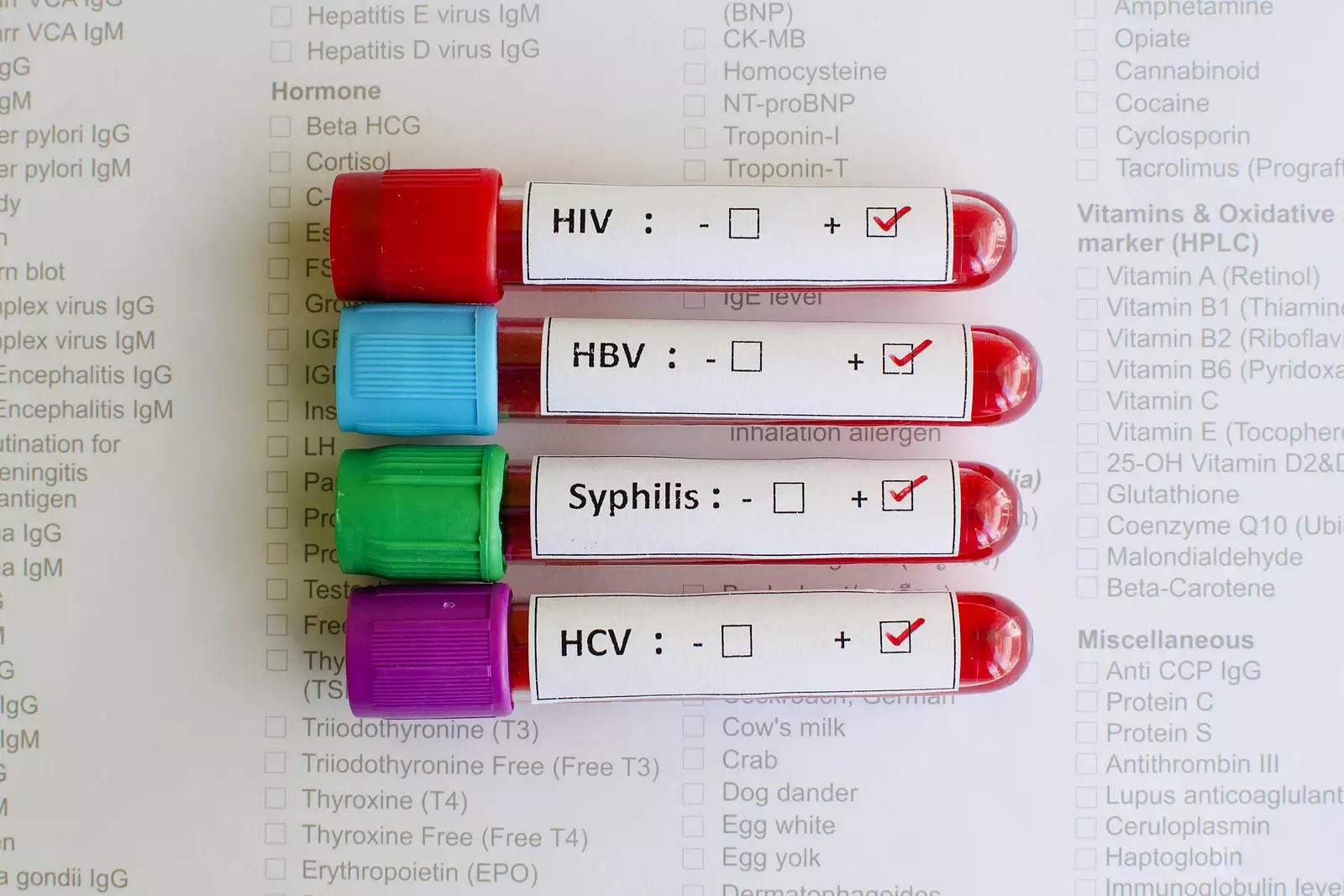 OMS apresenta nova diretriz para tratamento de infecções sexualmente transmissíveis